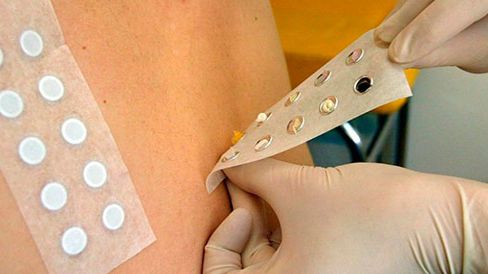 Diagnosticering af allergi