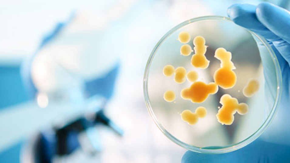 En bakteriekoloni i en petriskål i et laboratorium